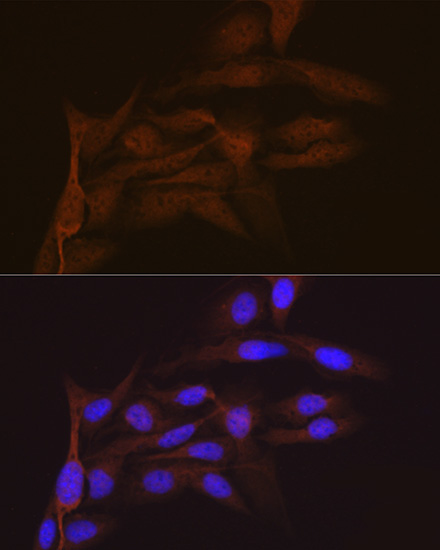 SMC4 Rabbit Monoclonal Antibody - Image 4