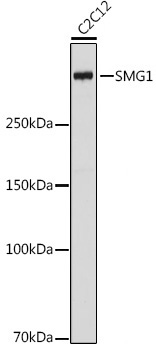 SMG1 Rabbit Monoclonal Antibody