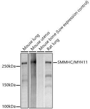 SMMHC/MYH11 Rabbit Monoclonal Antibody