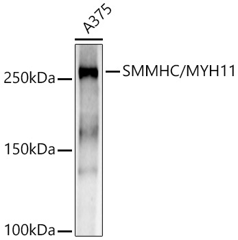 SMMHC/MYH11 Rabbit Monoclonal Antibody - Image 2