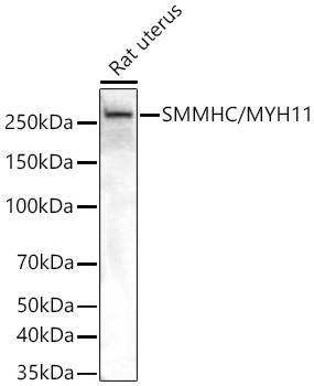 SMMHC/MYH11 Rabbit Monoclonal Antibody