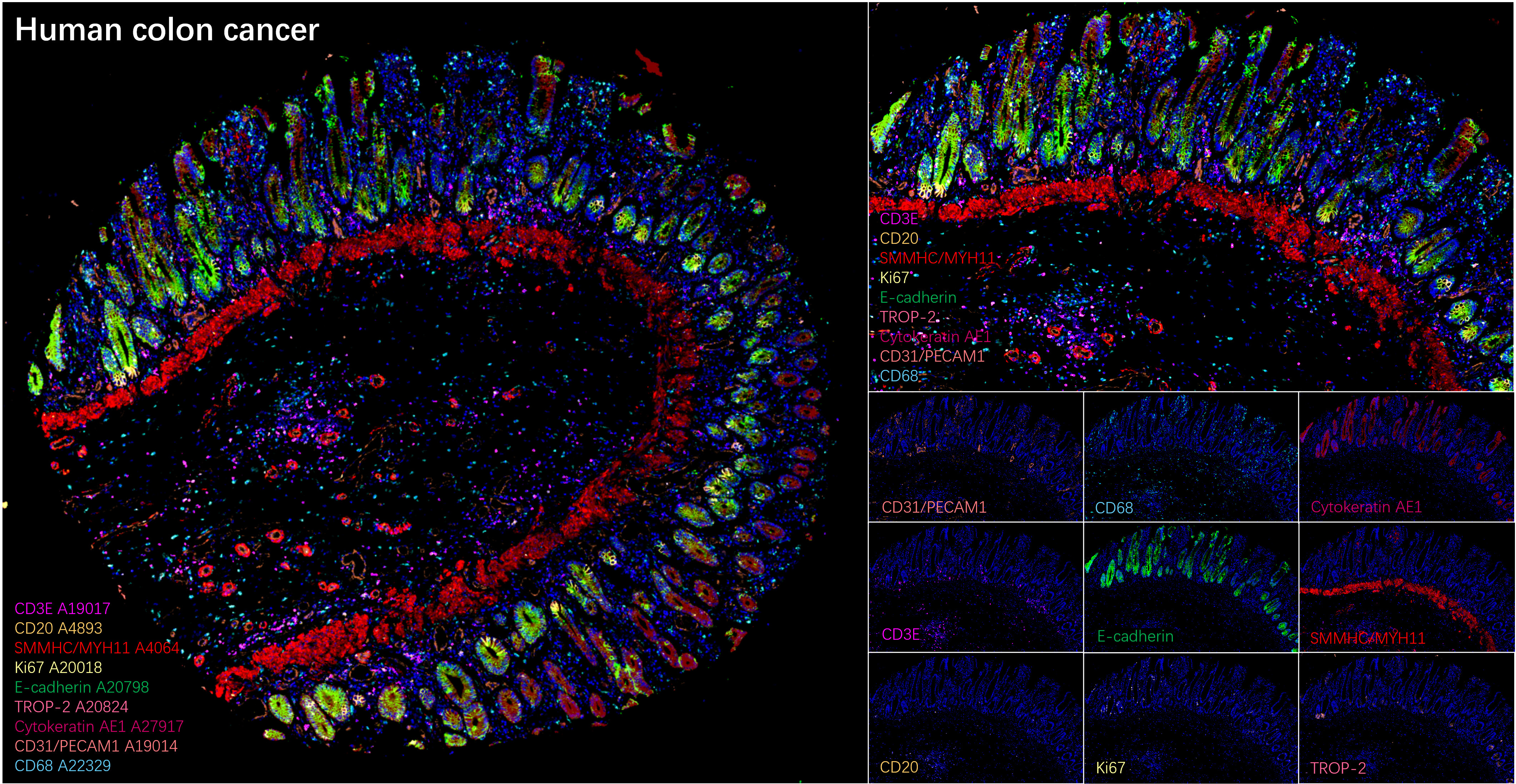 SMMHC/MYH11 Rabbit Monoclonal Antibody - Image 2