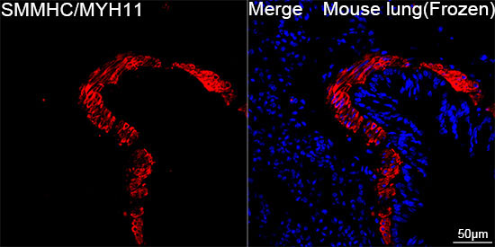 SMMHC/MYH11 Rabbit Monoclonal Antibody - Image 3