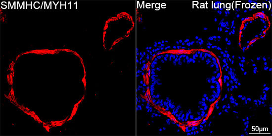 SMMHC/MYH11 Rabbit Monoclonal Antibody - Image 4