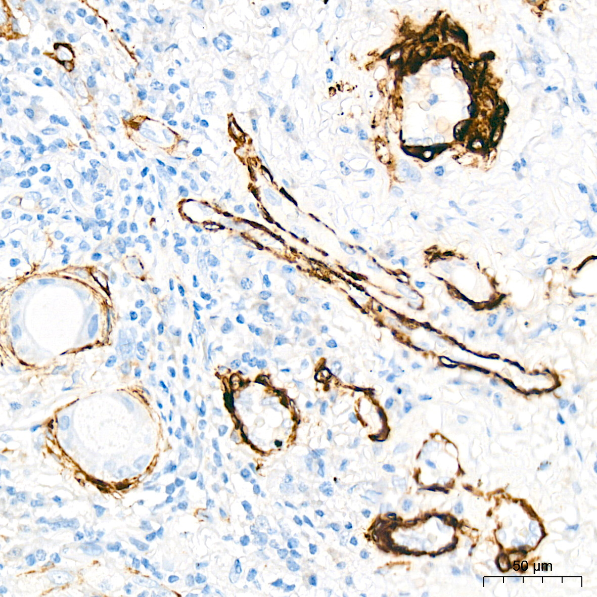 SMMHC/MYH11 Rabbit Monoclonal Antibody - Image 5