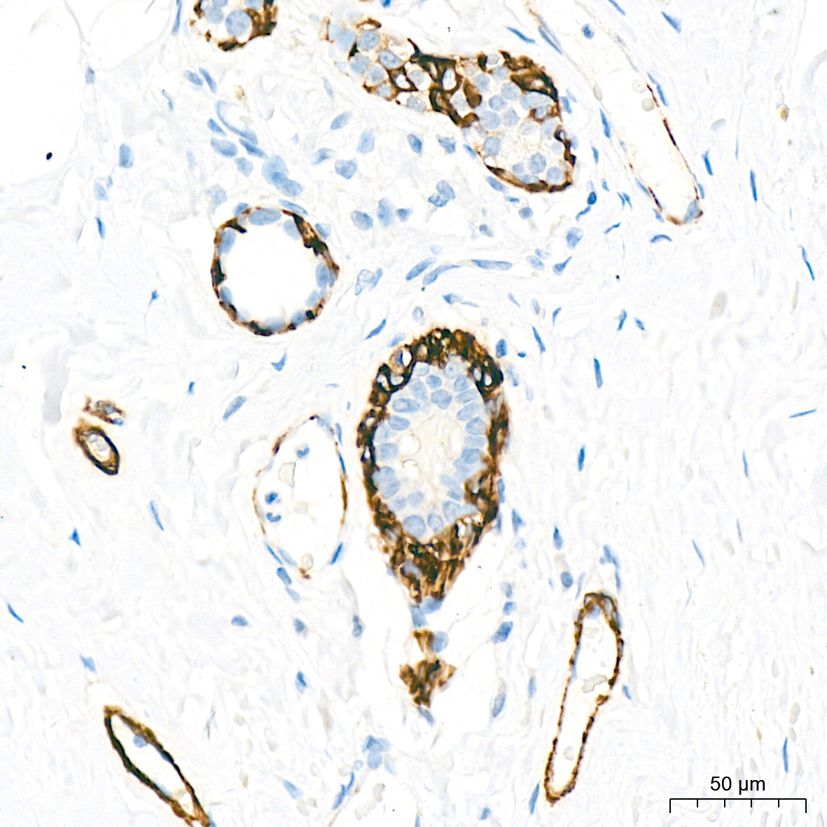 SMMHC/MYH11 Rabbit Monoclonal Antibody - Image 6