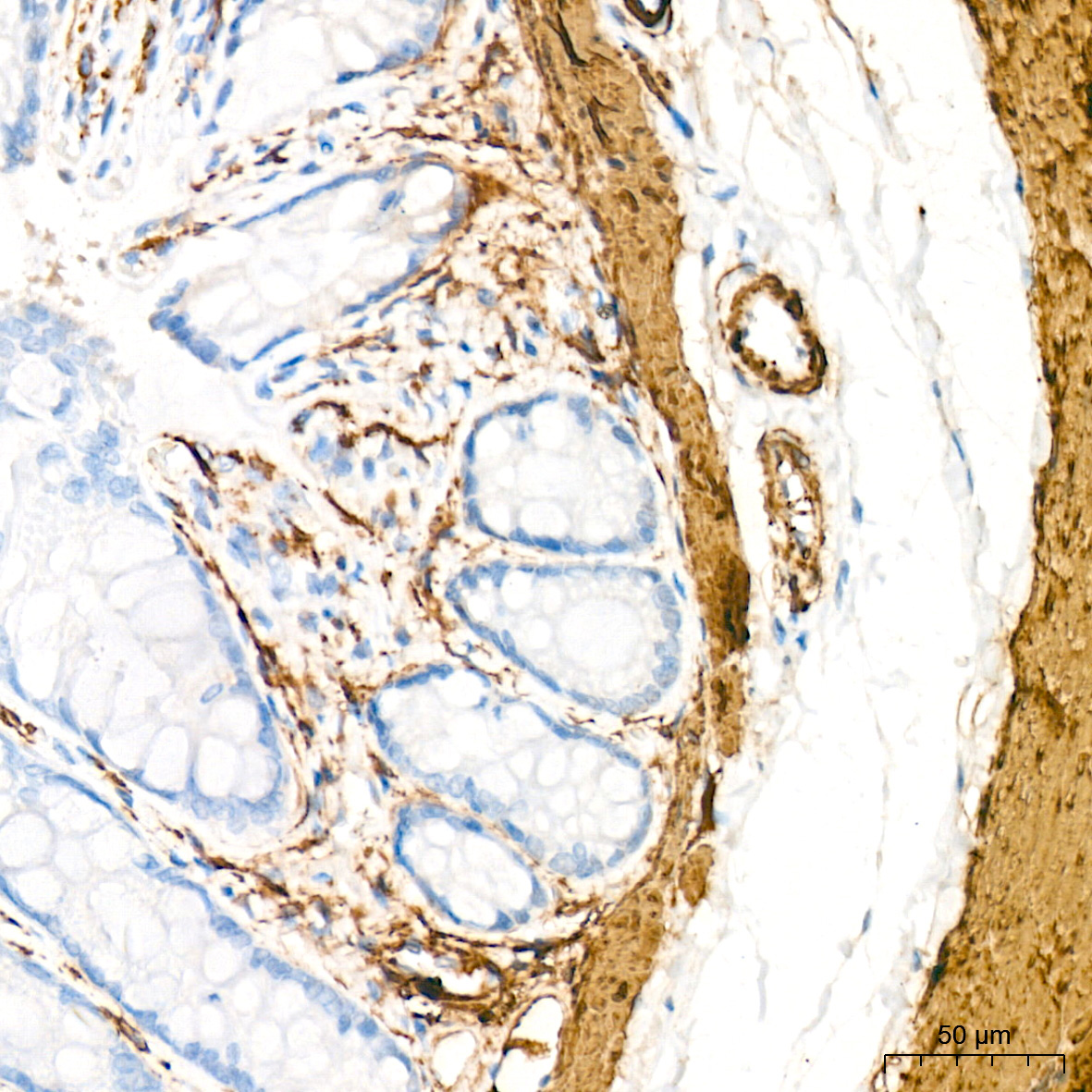SMMHC/MYH11 Rabbit Monoclonal Antibody - Image 9