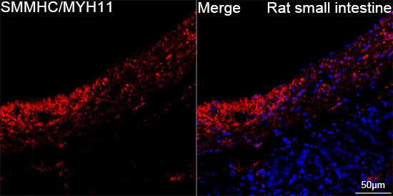 SMMHC/MYH11 Rabbit Monoclonal Antibody - Image 10