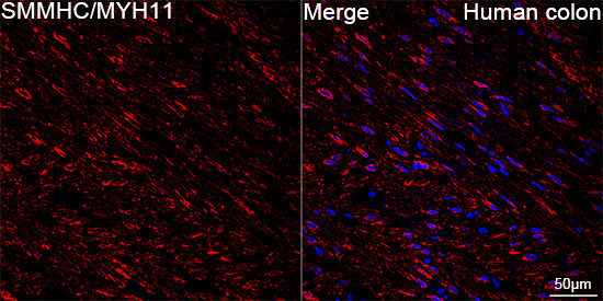 SMMHC/MYH11 Rabbit Monoclonal Antibody - Image 11