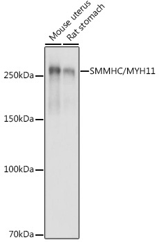 SMMHC/MYH11 Rabbit Polyclonal Antibody