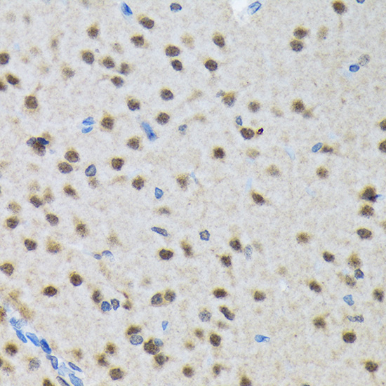SMN1 Rabbit Monoclonal Antibody - Image 2
