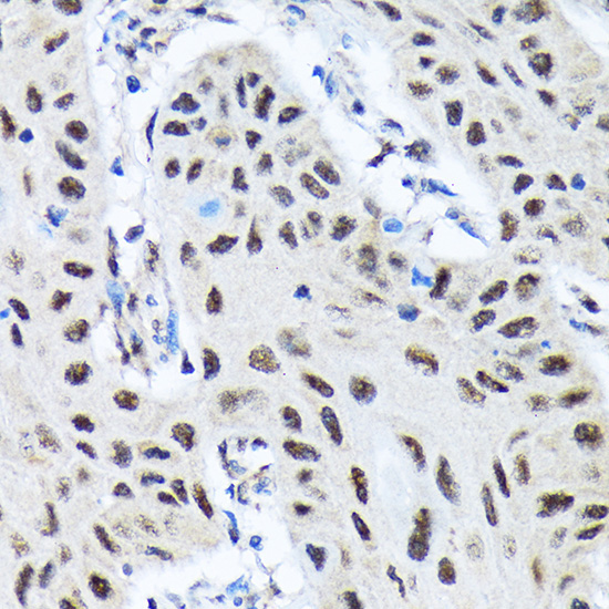 SMN1 Rabbit Monoclonal Antibody - Image 3