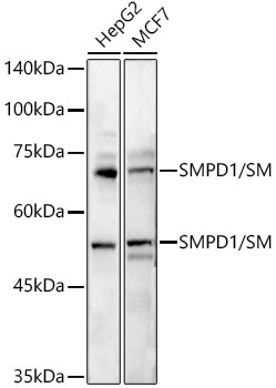 SMPD1 / ASM Rabbit Polyclonal Antibody