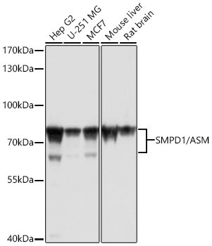 SMPD1 / ASM Rabbit Polyclonal Antibody