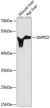 SMPD2 Rabbit Polyclonal Antibody