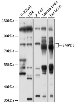 SMPD3 Rabbit Polyclonal Antibody