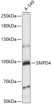 SMPD4 Rabbit Polyclonal Antibody