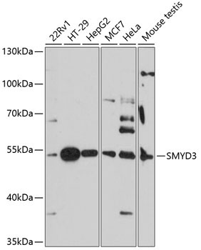 SMYD3 Rabbit Polyclonal Antibody
