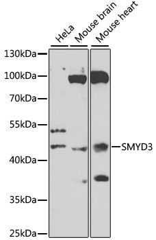 SMYD3 Rabbit Polyclonal Antibody