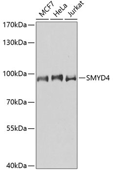 SMYD4 Rabbit Polyclonal Antibody
