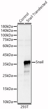 Snail Rabbit Polyclonal Antibody