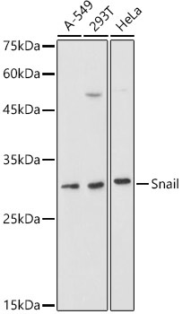 Snail Rabbit Polyclonal Antibody