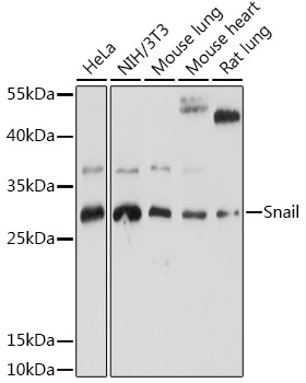 Snail Rabbit Polyclonal Antibody
