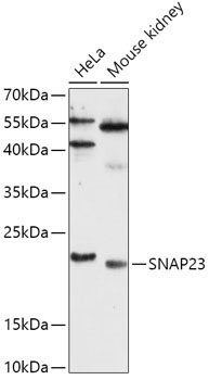 SNAP23 Rabbit Polyclonal Antibody