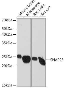 SNAP25 Rabbit Monoclonal Antibody