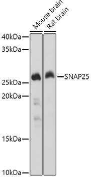 SNAP25 Rabbit Polyclonal Antibody