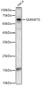 SNRNP70 Rabbit Polyclonal Antibody