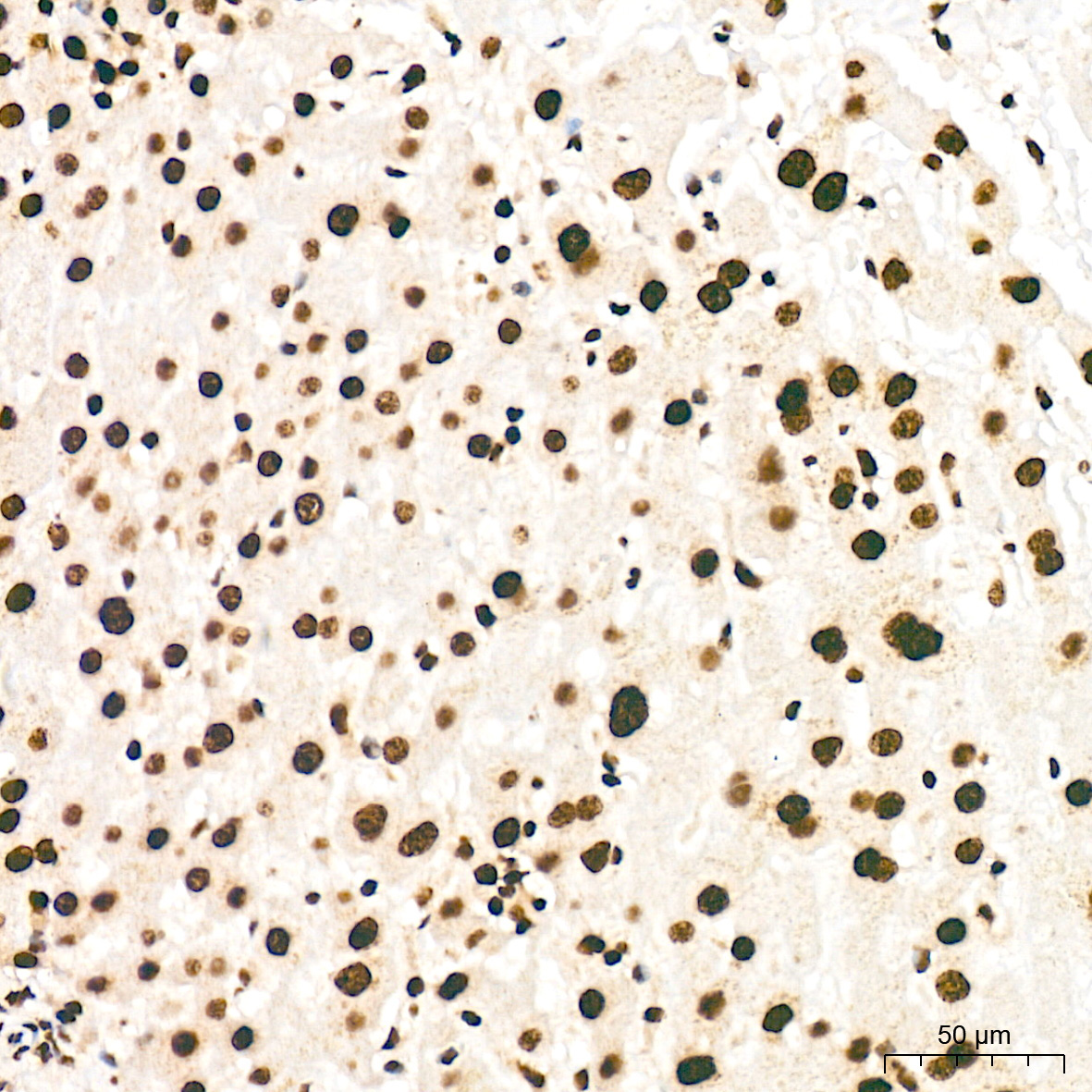 SNRPA1 Rabbit Monoclonal Antibody - Image 2
