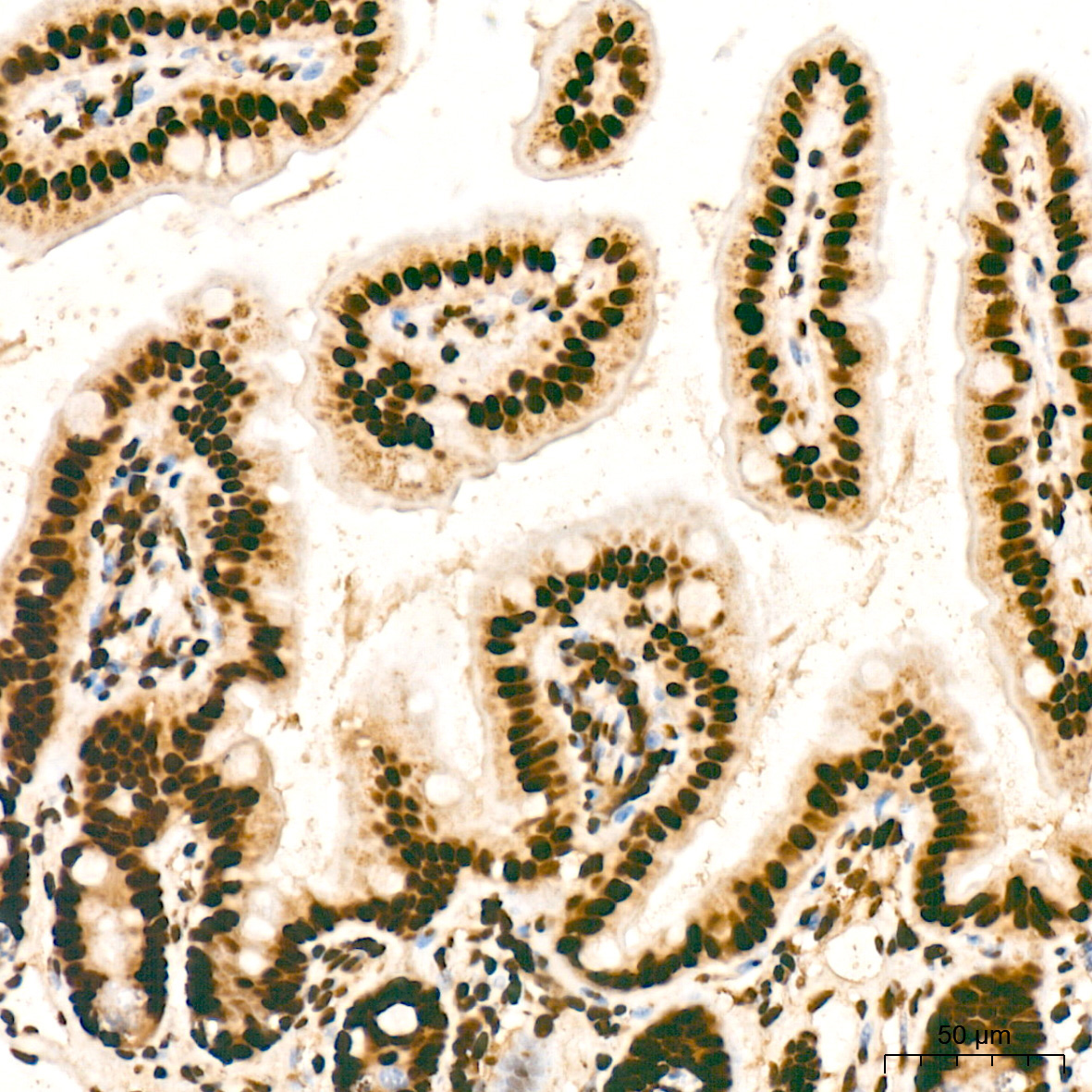 SNRPA1 Rabbit Monoclonal Antibody - Image 6