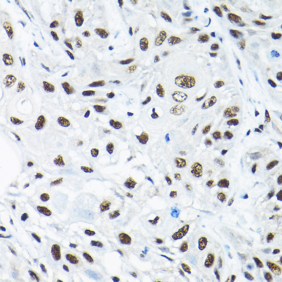 SNRPA1 Rabbit Polyclonal Antibody - Image 2