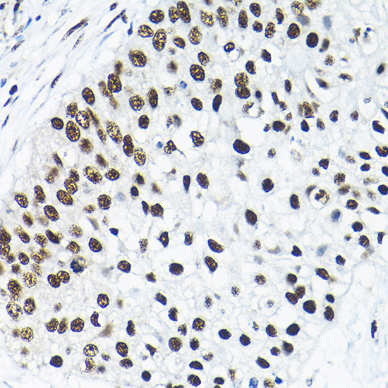 SNRPA1 Rabbit Polyclonal Antibody - Image 3
