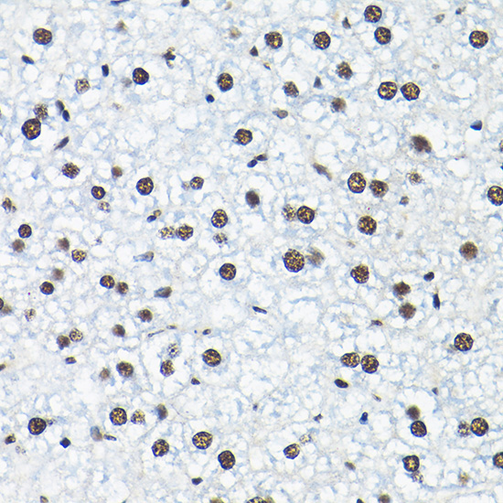 SNRPA1 Rabbit Polyclonal Antibody - Image 4
