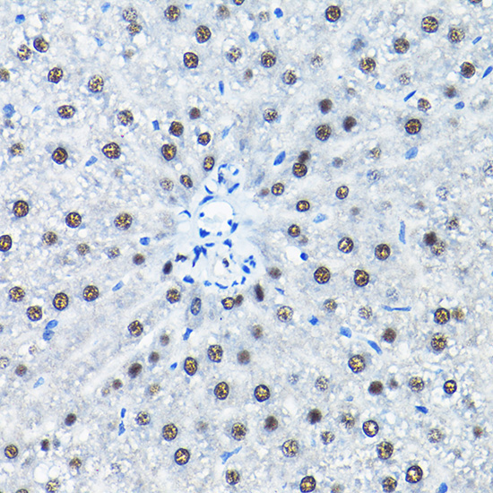 SNRPA1 Rabbit Polyclonal Antibody - Image 5