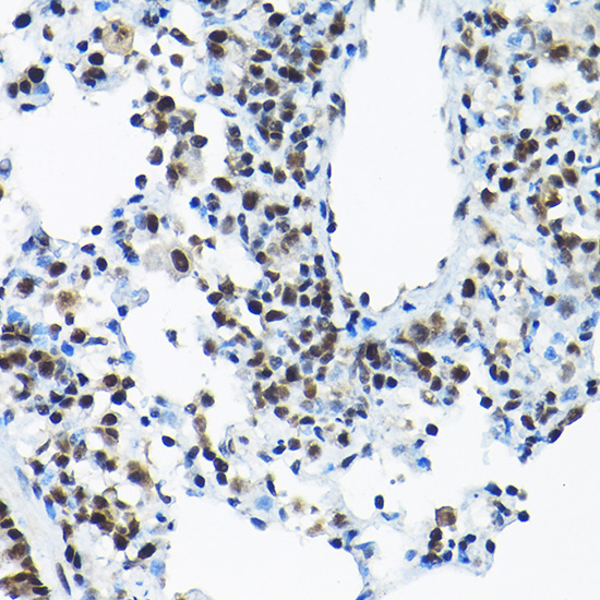 SNRPA1 Rabbit Polyclonal Antibody - Image 6