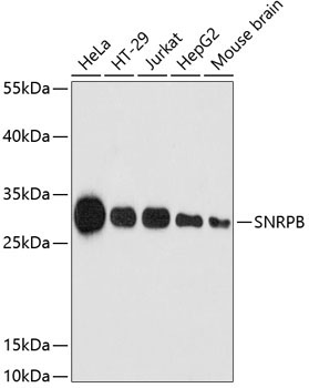 SNRPB Rabbit Polyclonal Antibody