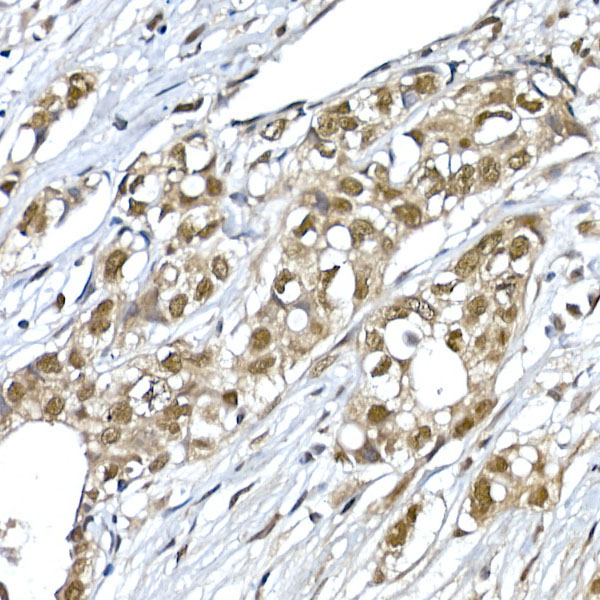 SNRPD1 Rabbit Polyclonal Antibody - Image 2