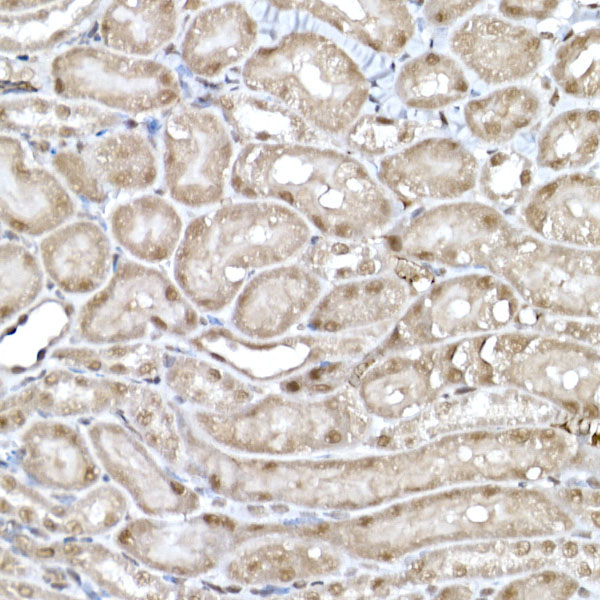 SNRPD1 Rabbit Polyclonal Antibody - Image 3