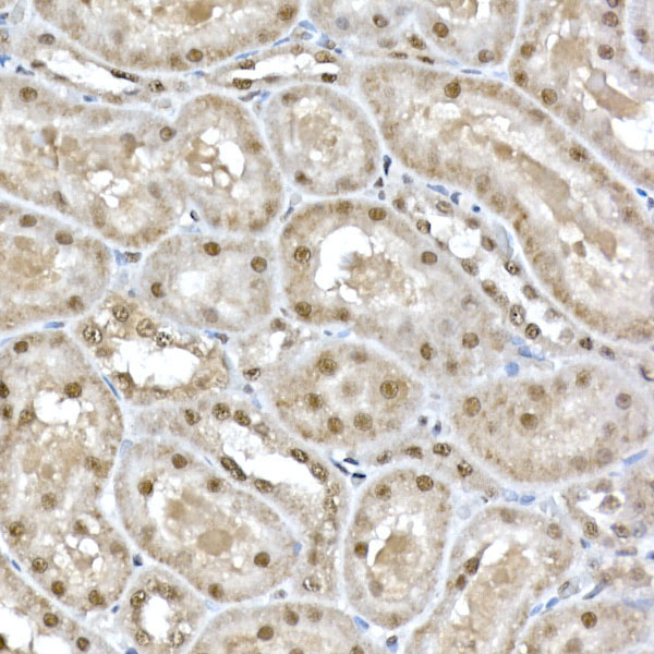 SNRPD1 Rabbit Polyclonal Antibody - Image 4