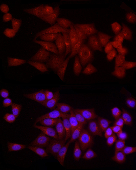 SNRPD1 Rabbit Polyclonal Antibody - Image 5