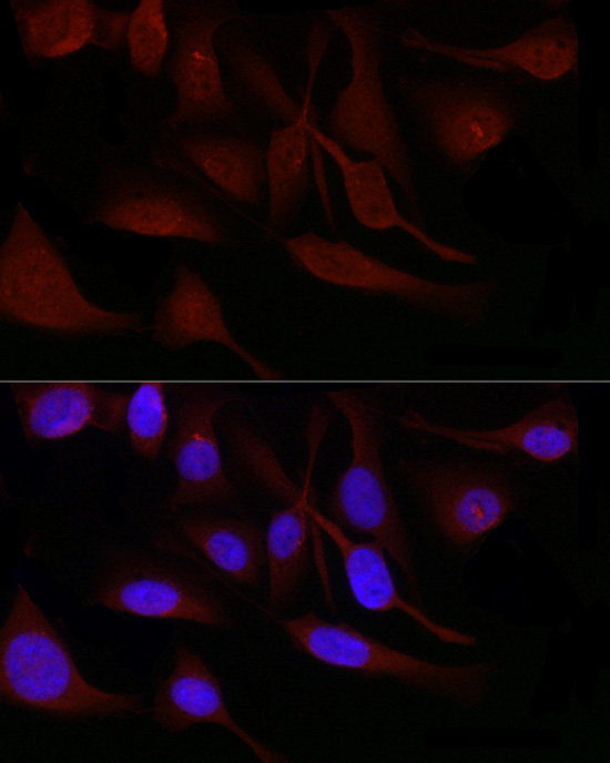 SNRPD1 Rabbit Polyclonal Antibody - Image 6