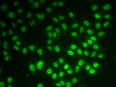 SNRPD1 Rabbit Polyclonal Antibody