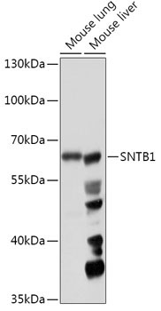SNTB1 Rabbit Polyclonal Antibody