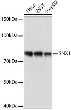 SNX1 Rabbit Monoclonal Antibody