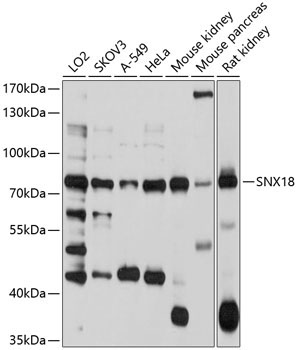 SNX18 Rabbit Polyclonal Antibody