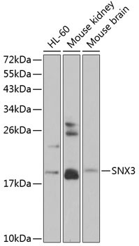 SNX3 Rabbit Polyclonal Antibody