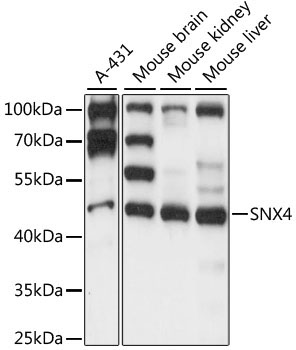 SNX4 Rabbit Polyclonal Antibody